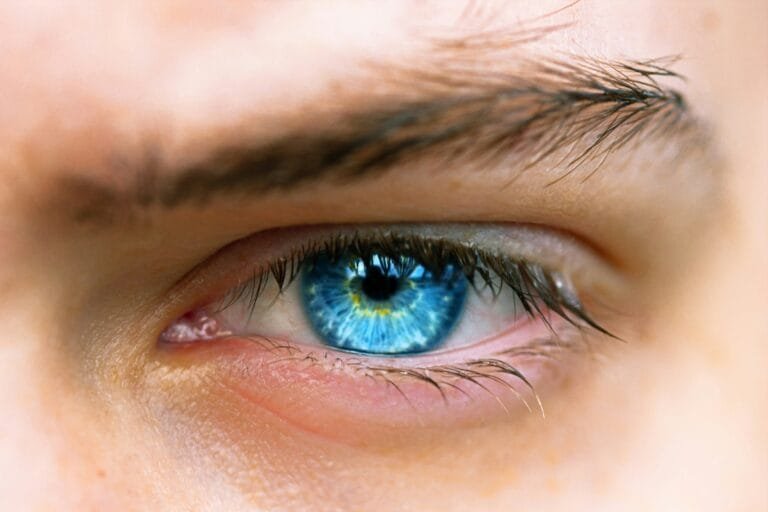 Crème apaisante pour les yeux